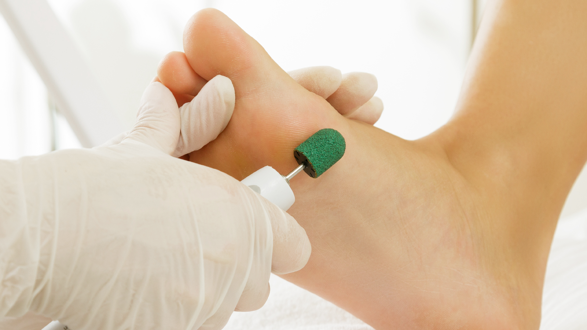 podolog-medikal-ayak-bakimi-2