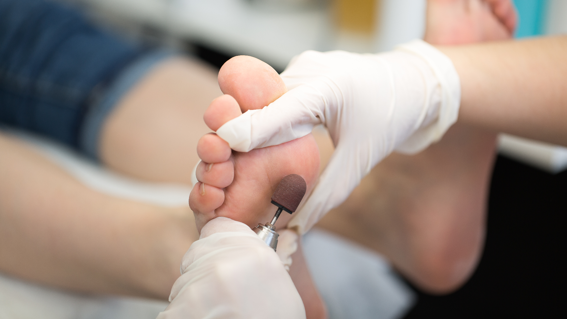 podolog-nasir-tedavisi-ve-bakimi